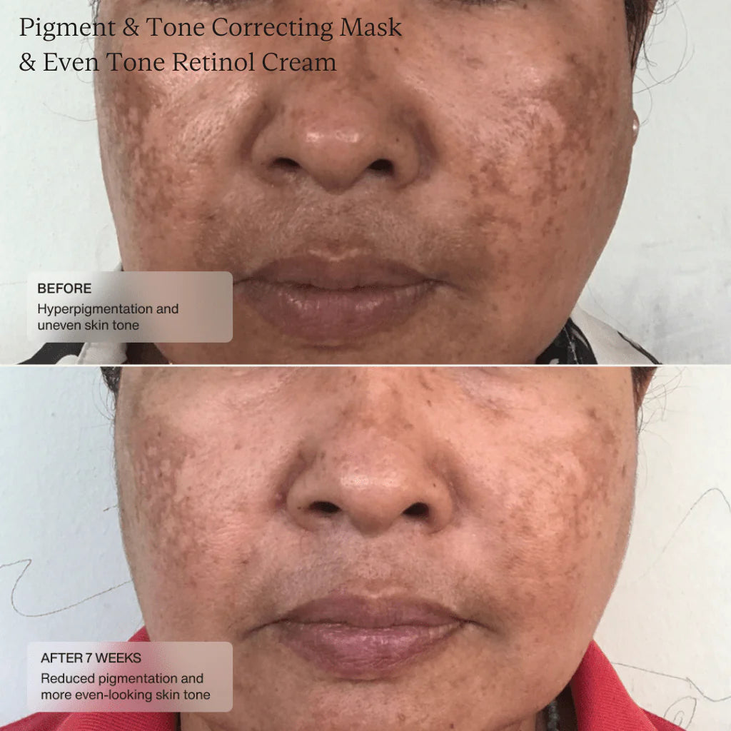 Senté Pigment & Tone Correcting Mask