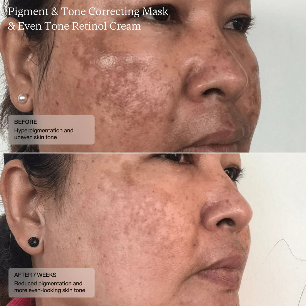 Senté Pigment & Tone Correcting Mask