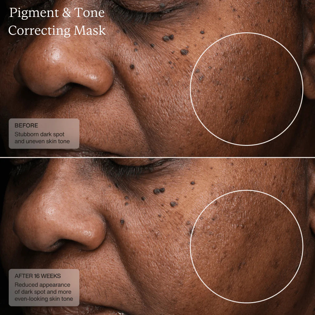 Senté Pigment & Tone Correcting Mask