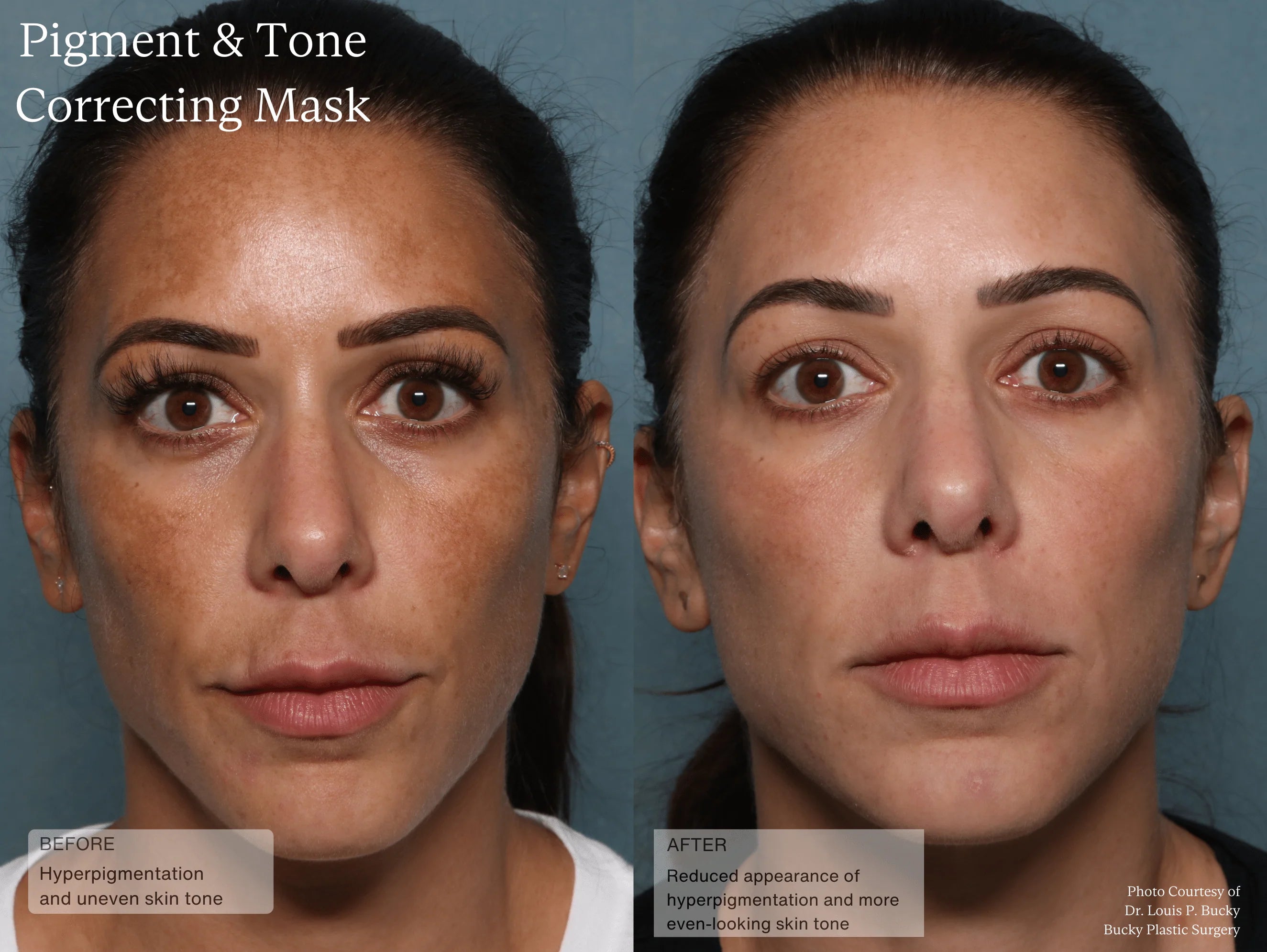 Senté Pigment & Tone Correcting Mask